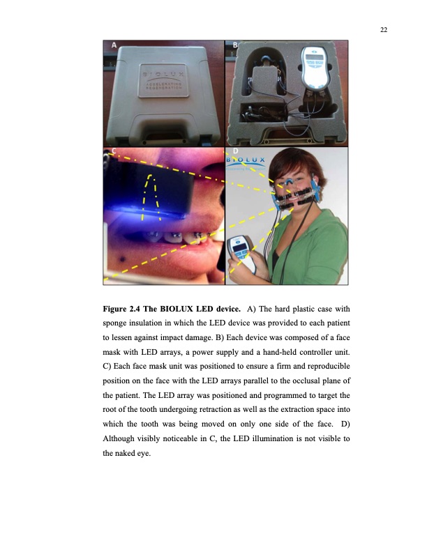 effect-led-phototherapy-rate-orthodontic-tooth-movement-034